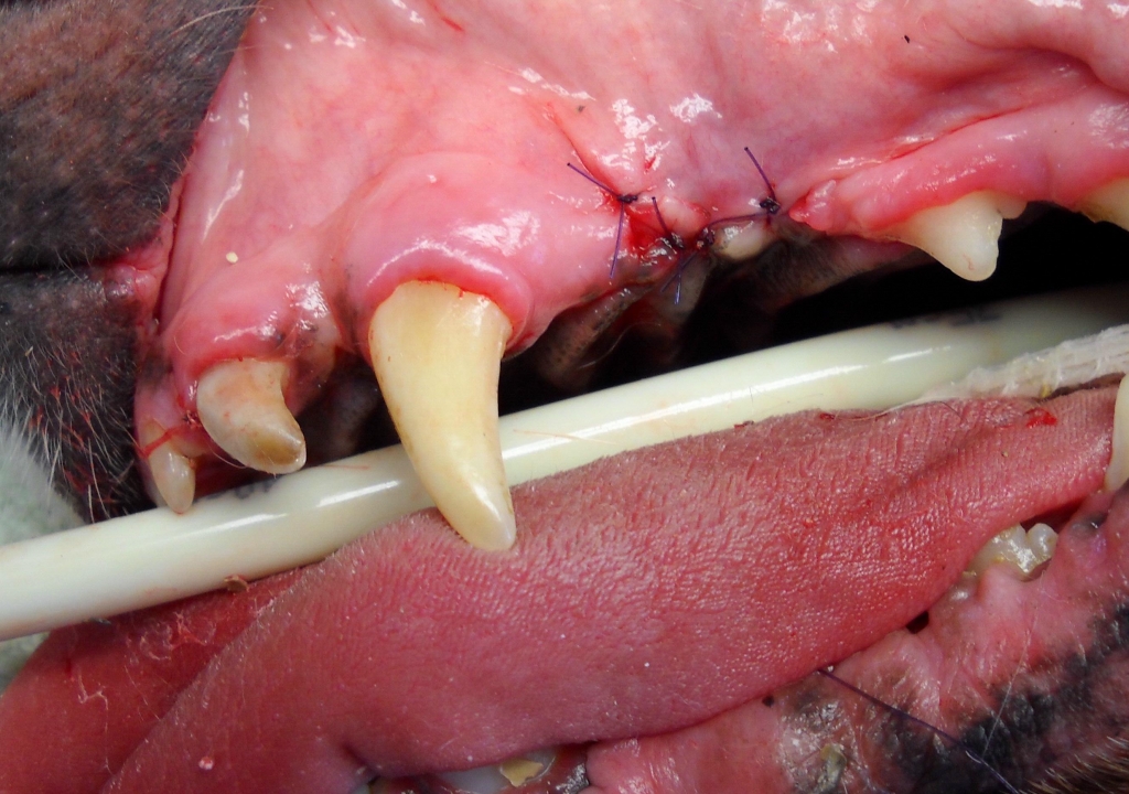 The tooth has been removed and a gingival flap is sutured over the socket.