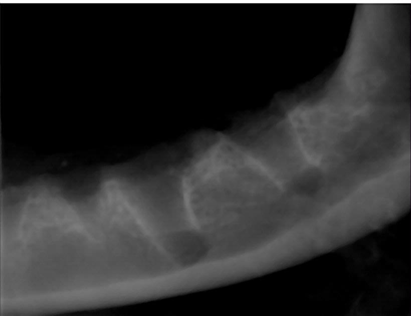 Dental  X-rays