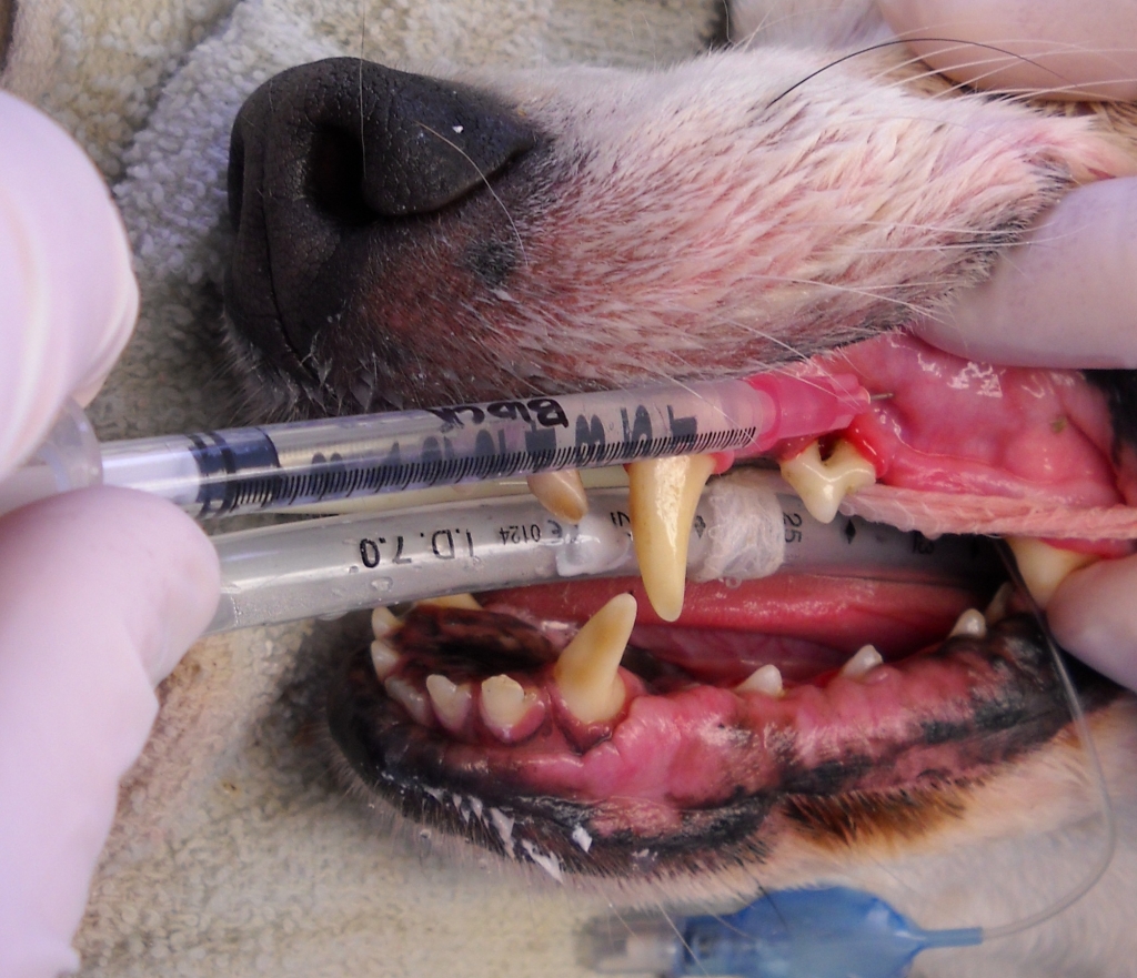 A local anesthetic block is being placed prior to removal of the tooth with the exposed roots.