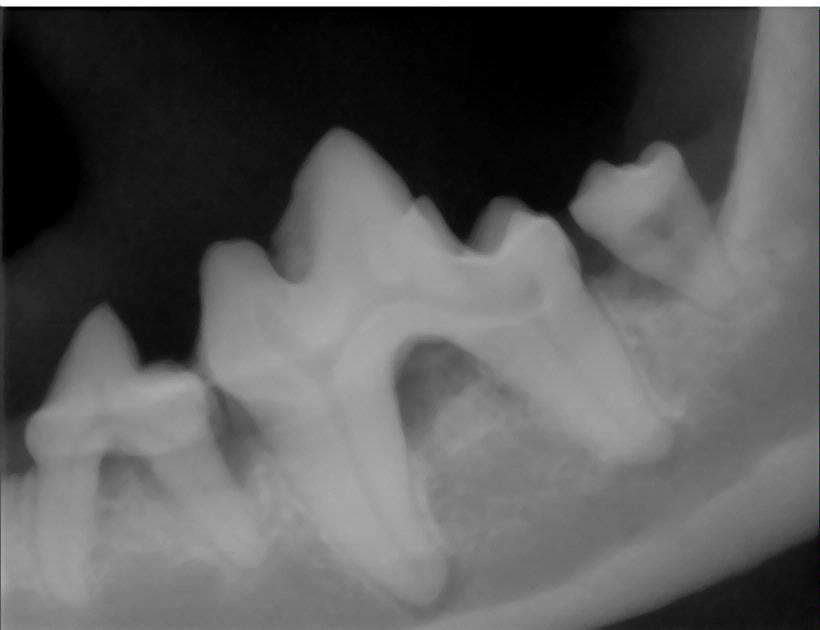 Dental  X-rays