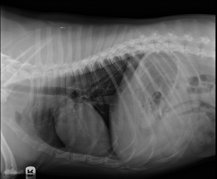 chest x-ray